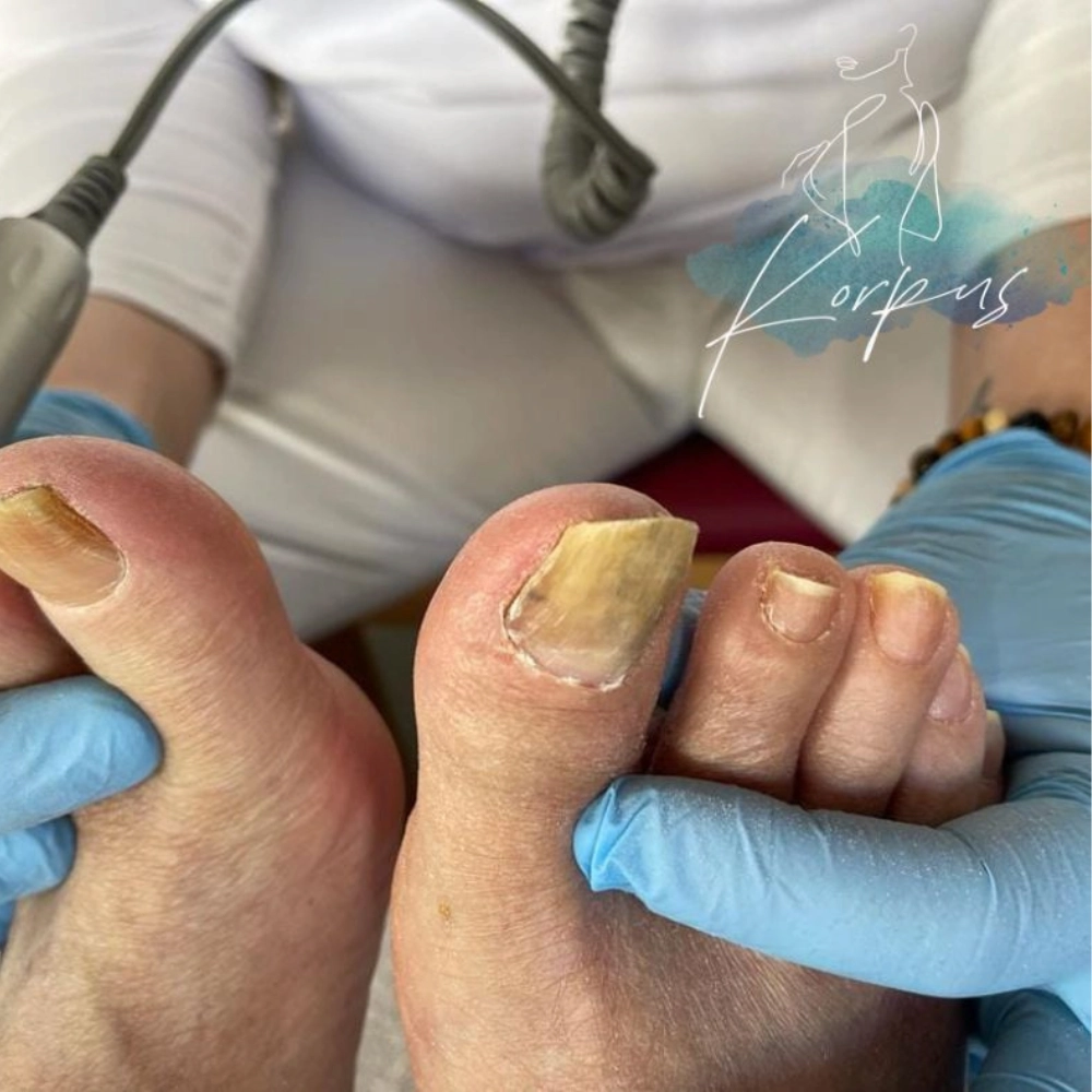 Imagem Slide 1 Pedicure Medical