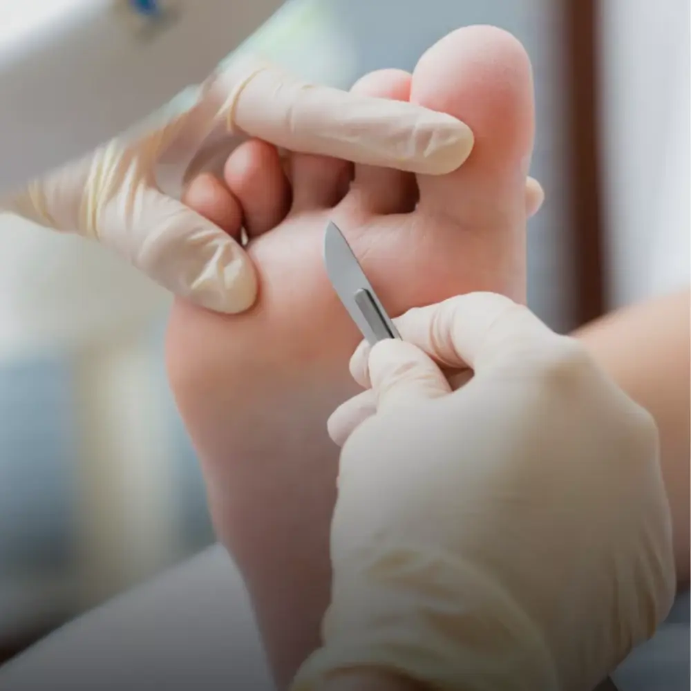 Imagem Pedicure Medical