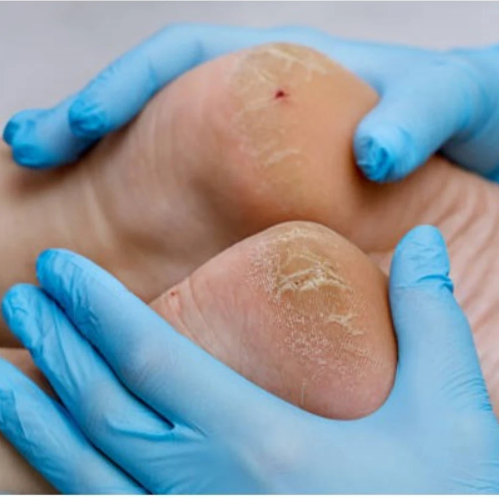 Imagem Slide 2 Pedicure Medical